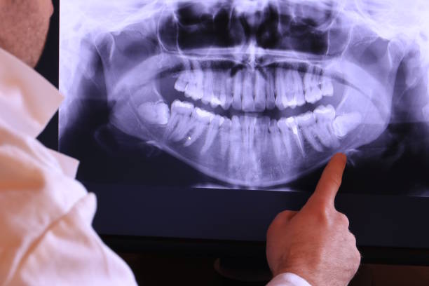 Best Emergency Dental Surgery in Columbia, CA